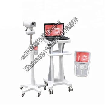 Горячая распродажа LH9800A Цифровая Электронная Видео кольпоскопия для гинекологии/Мобильный гинекологический аппарат для женщин